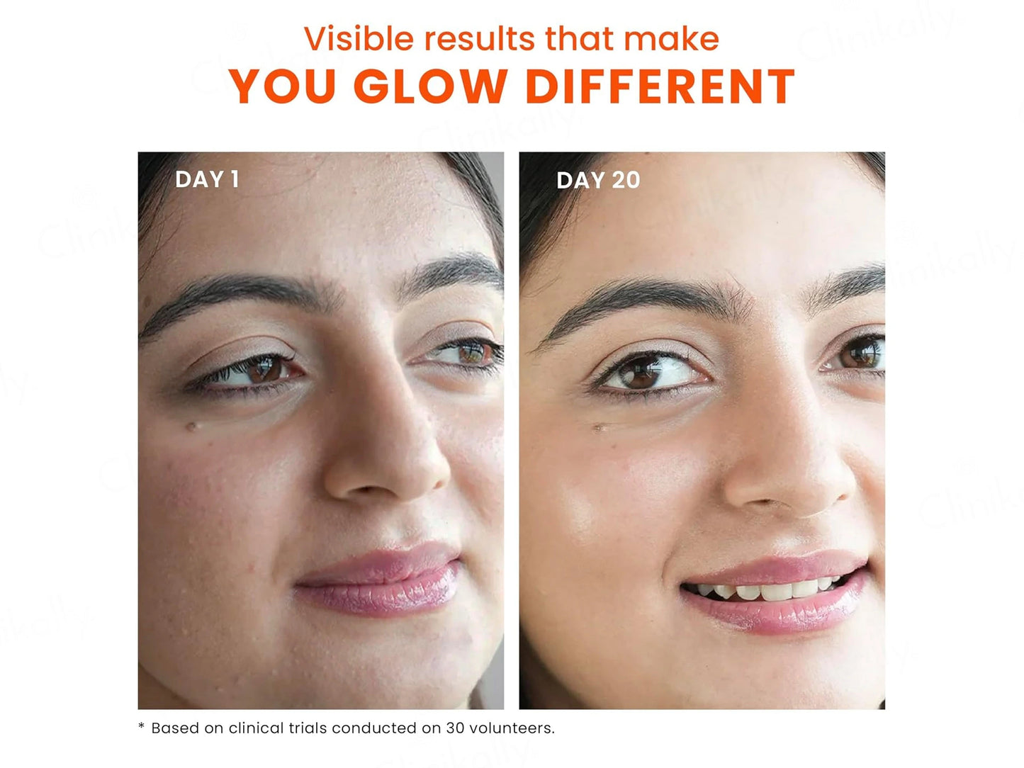 Foxtale Multivitamin Glow Toner Makeup Setting Spray