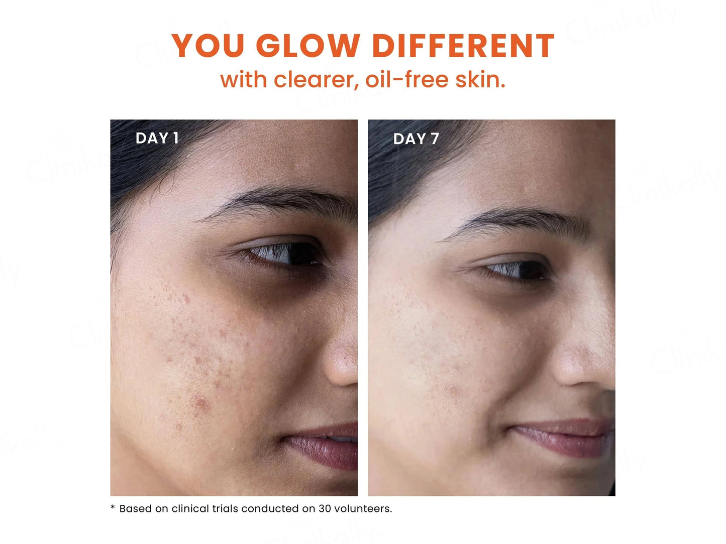 Foxtale Oil and Acne Control Face Wash