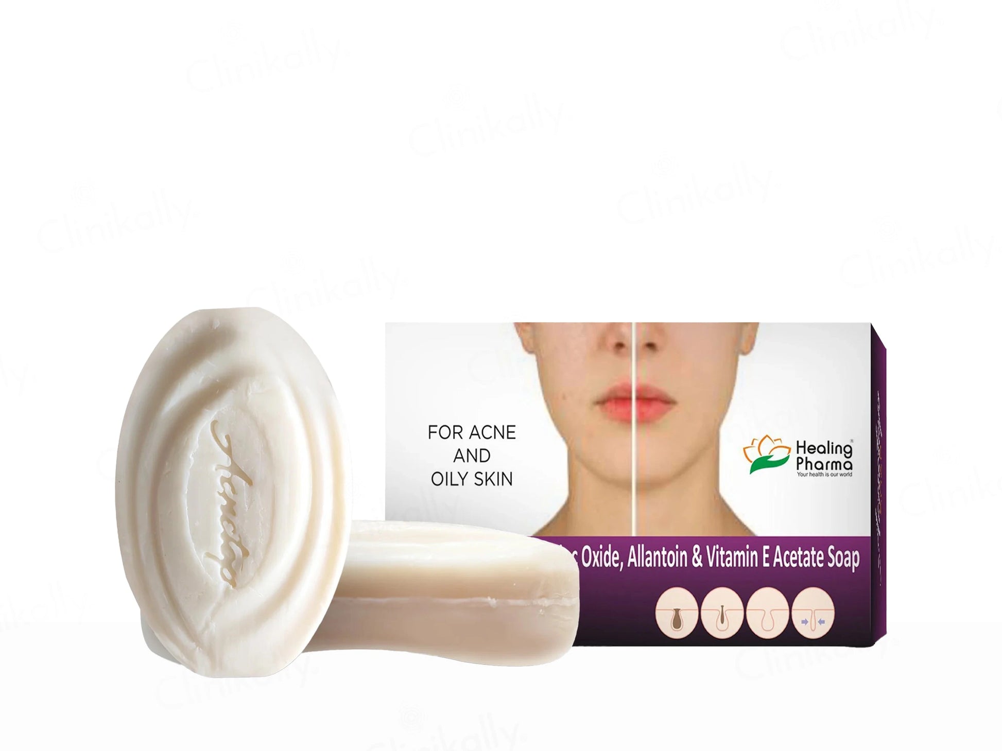 Acnetop Soap