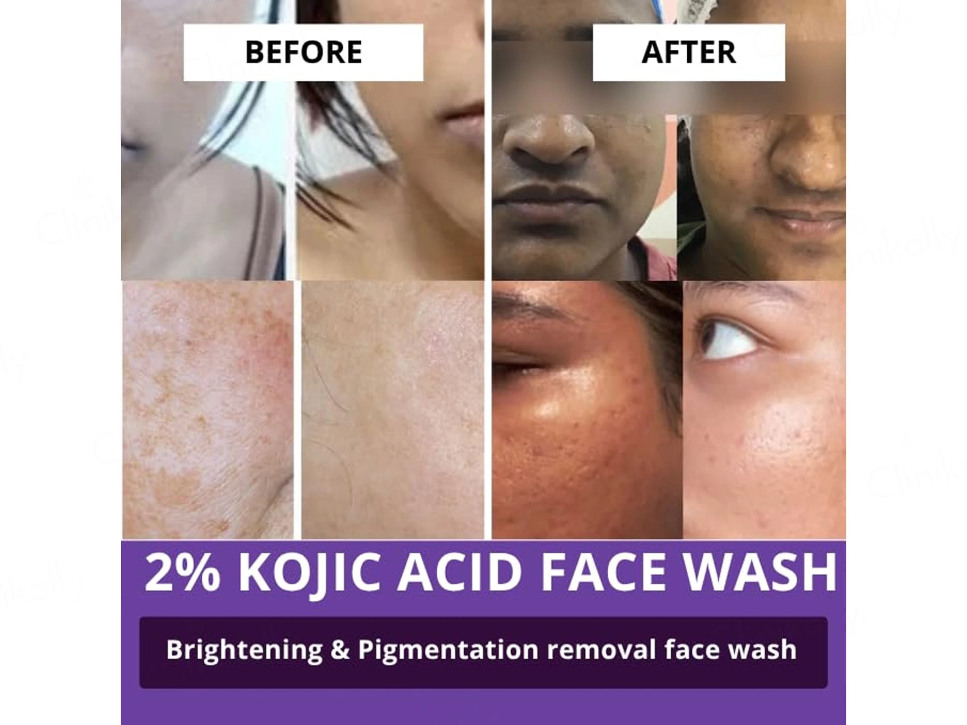 Bake 2 Percent Kojic Acid  Alpha Arbutin Facewash