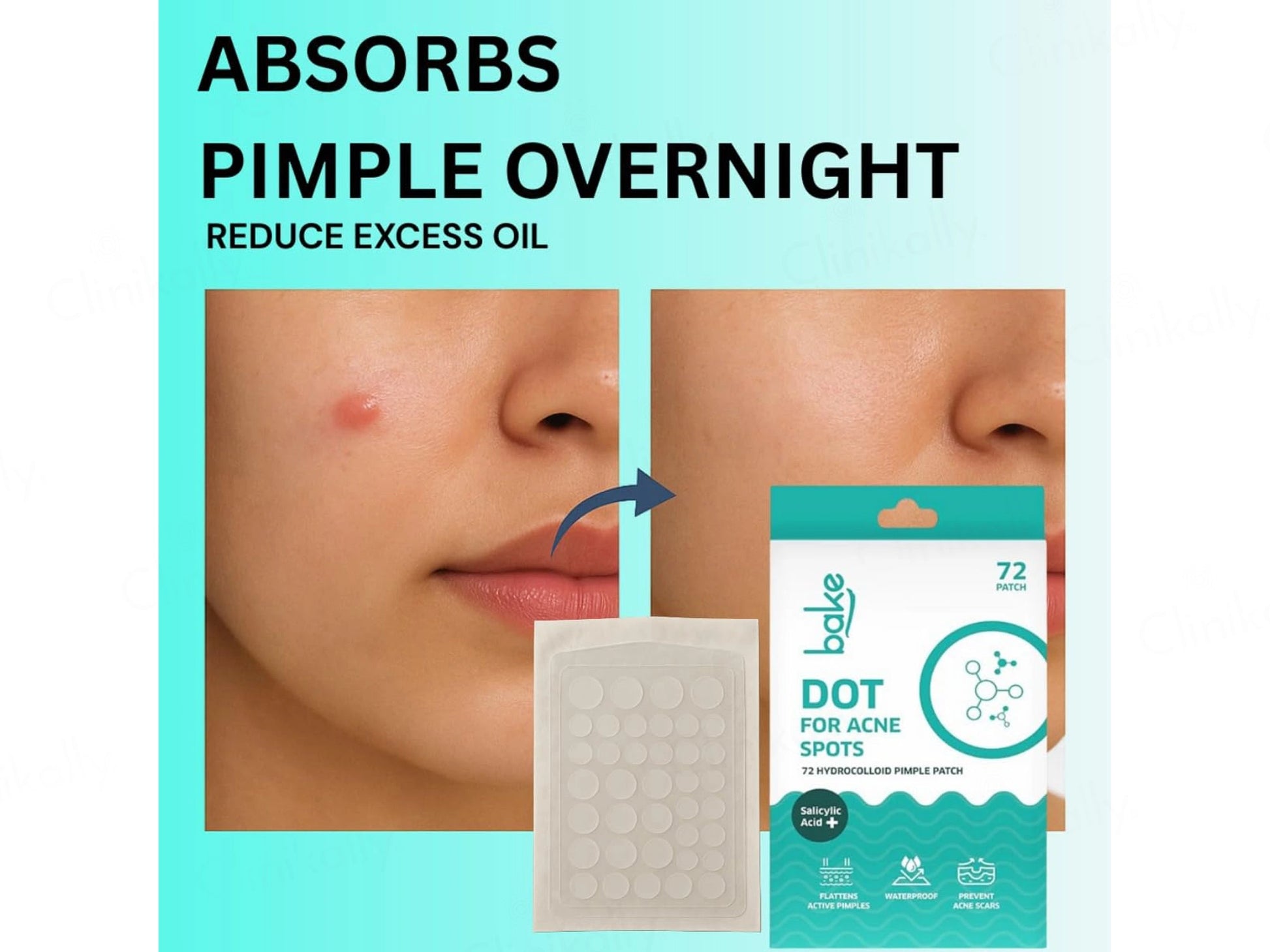 Bake Salicylic Acid Dot Acne Patch