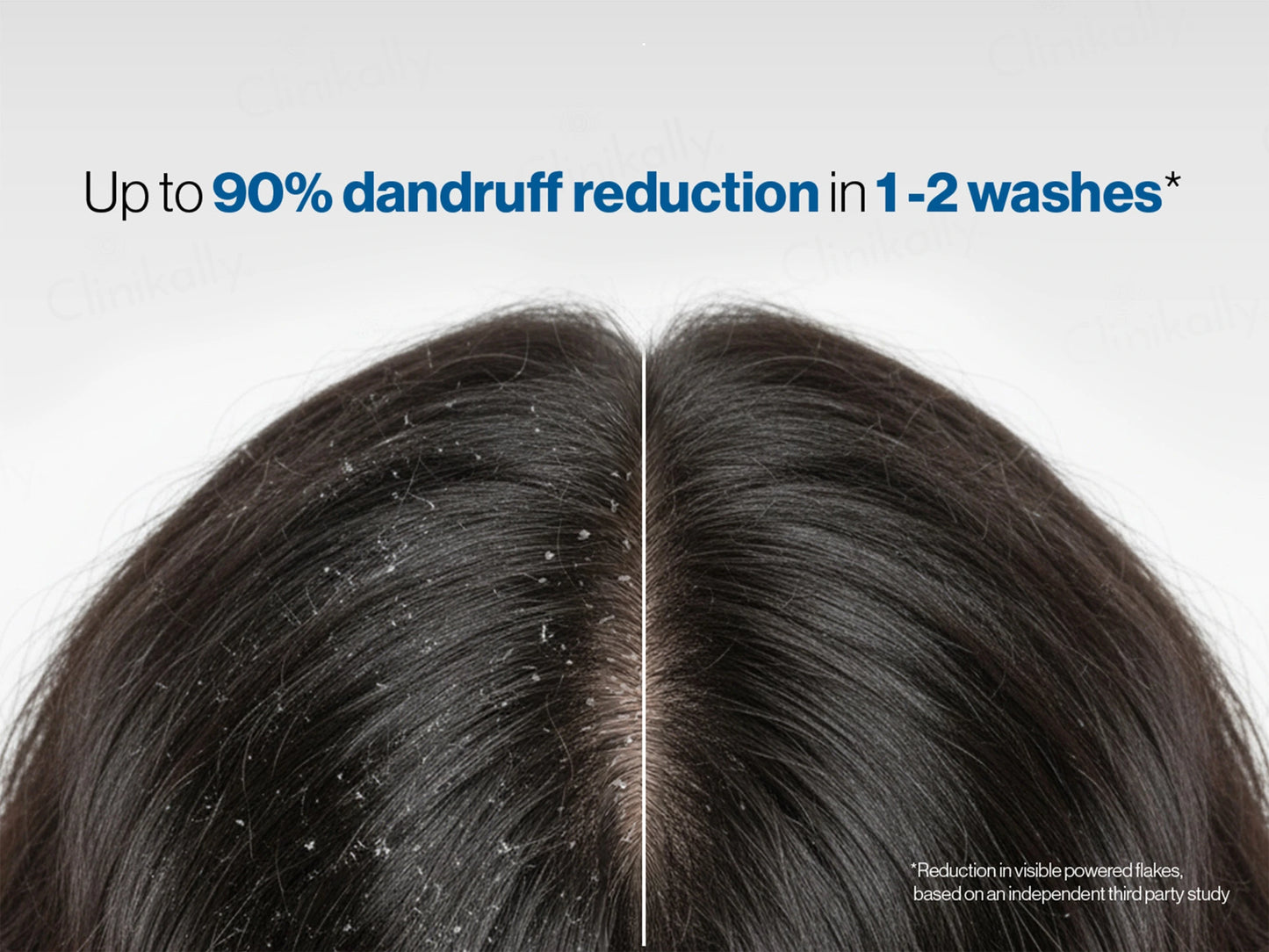 Be Bodywise 1 Percent Ketoconazole Dandruff Shampoo