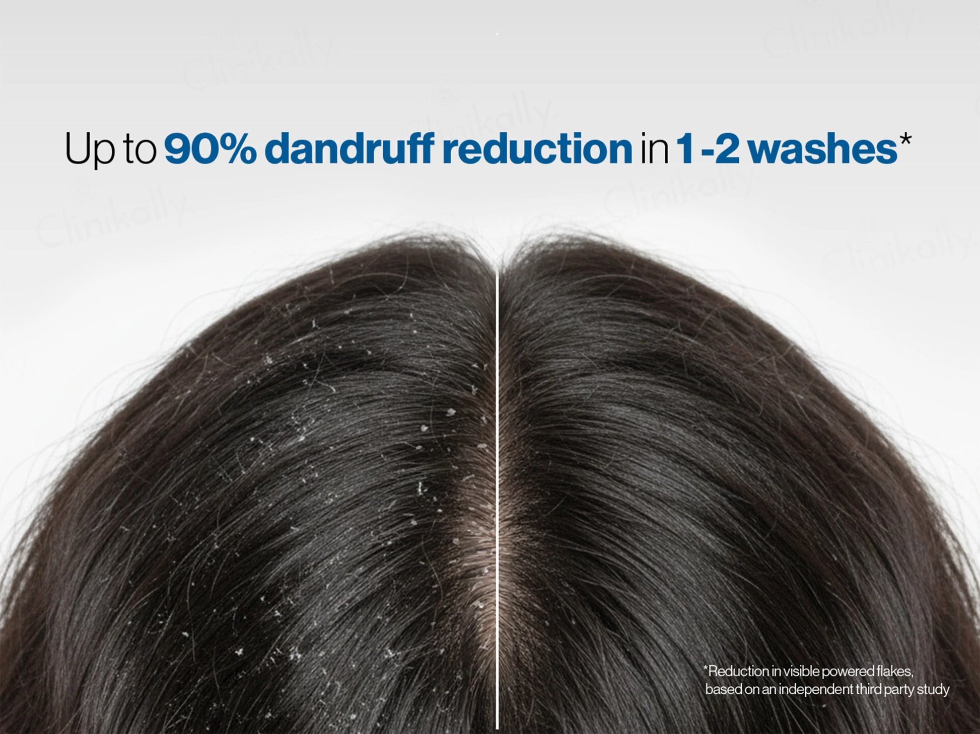 Be Bodywise 1 Percent Ketoconazole Dandruff Shampoo