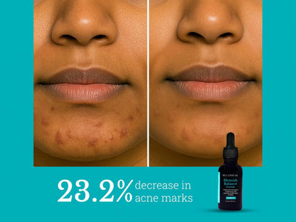 Be Clinical Blemish Balance Serum