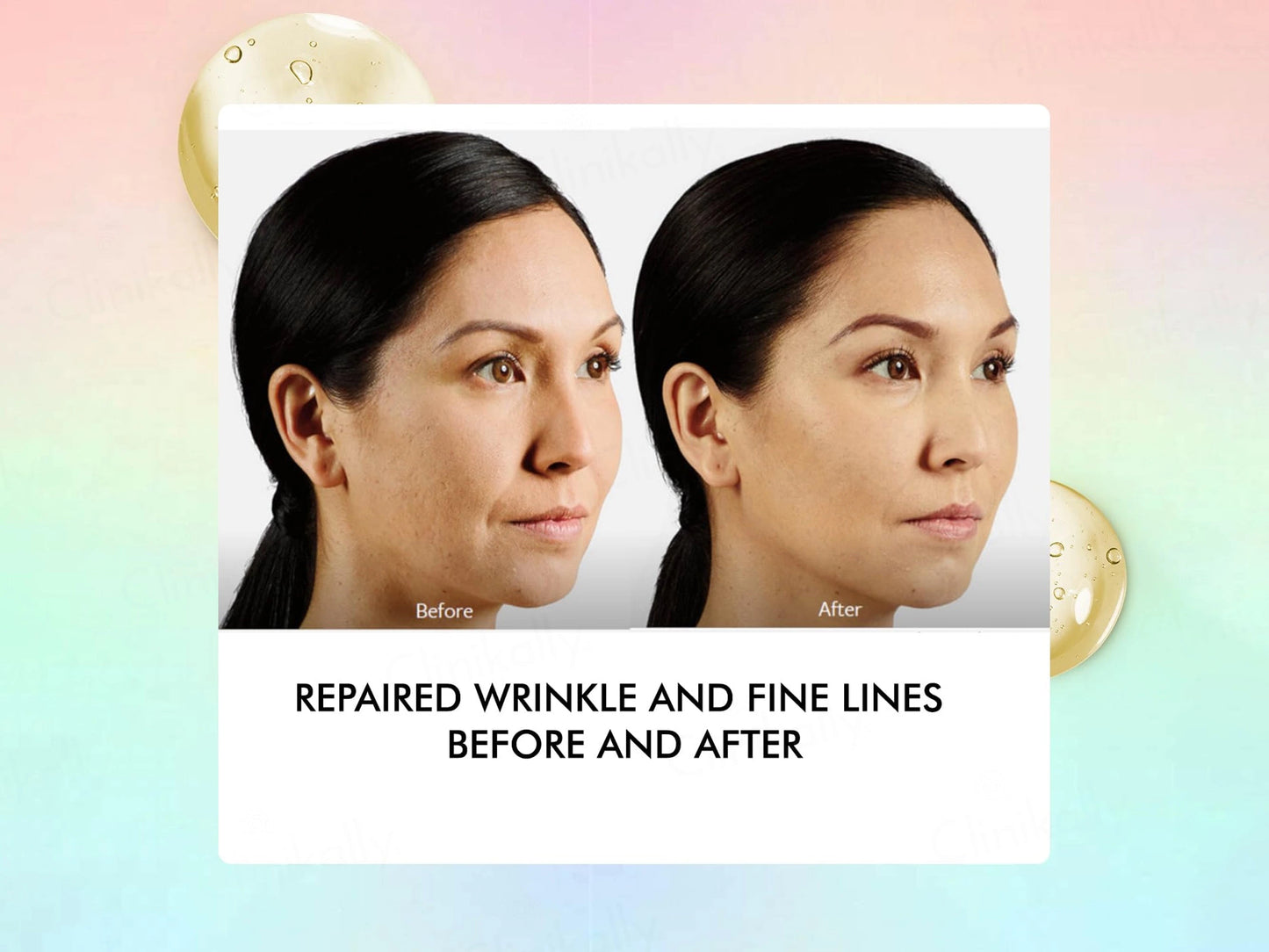 By Naked Fact Argireline  Squalene Anti Aging Serum