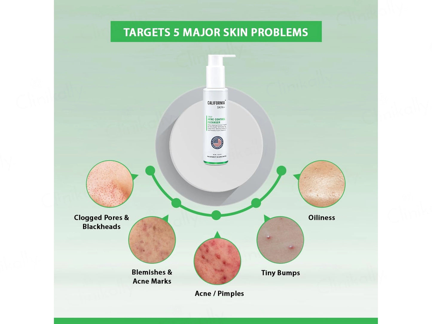 California Skin Acne Control Cleanser