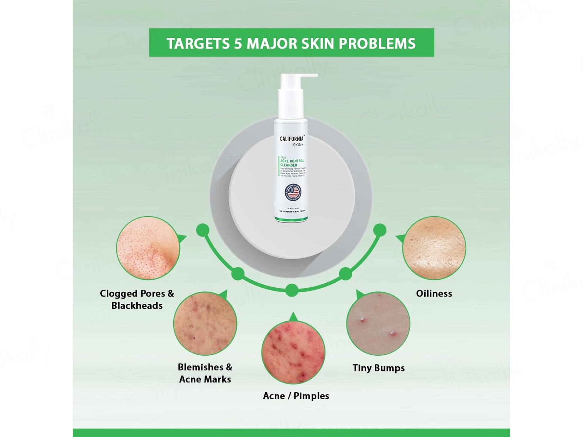 California Skin Acne Control Cleanser