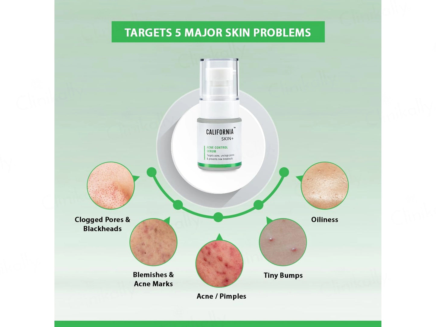 California Skin Acne Control Serum