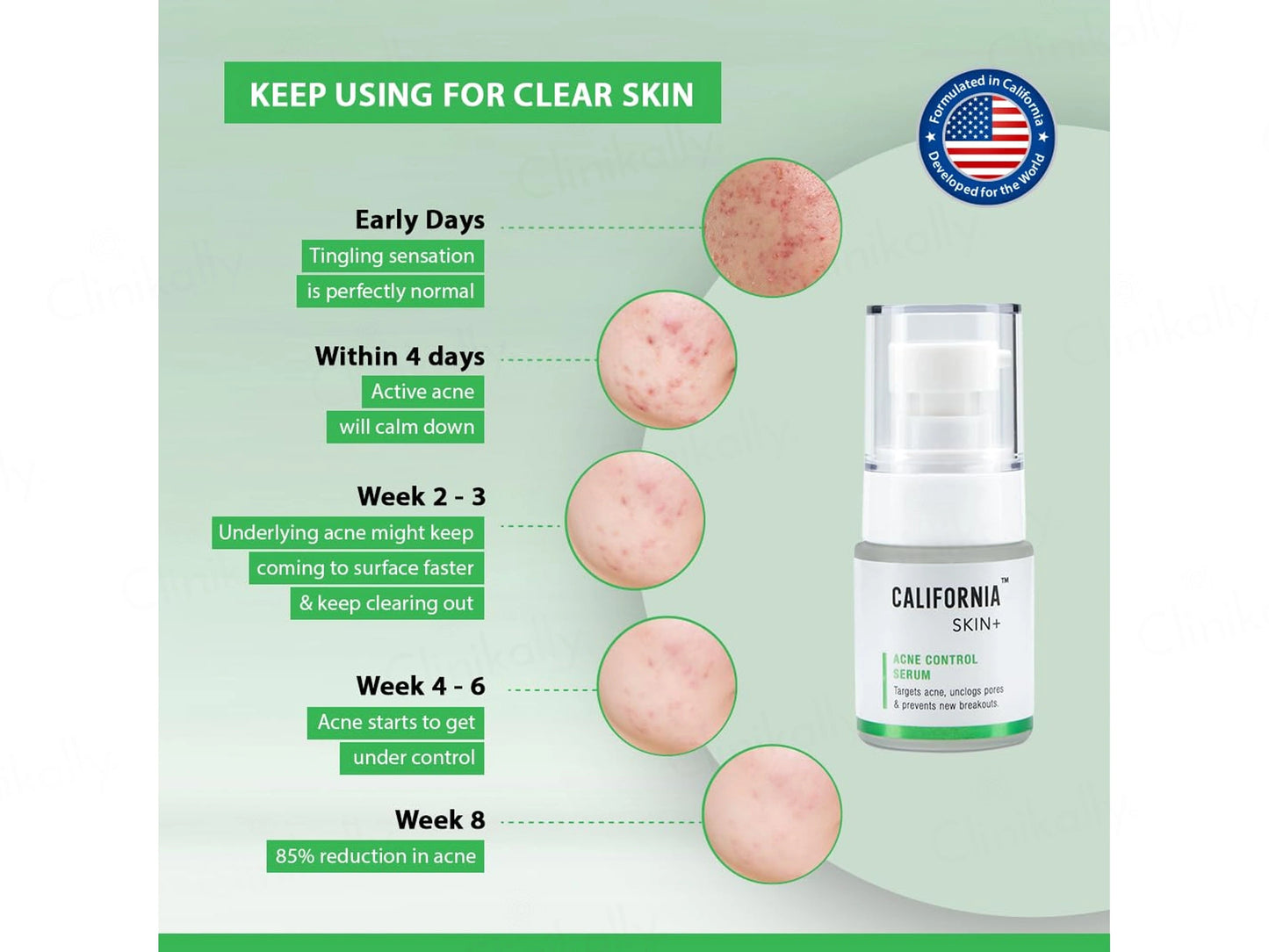 California Skin Acne Control Serum