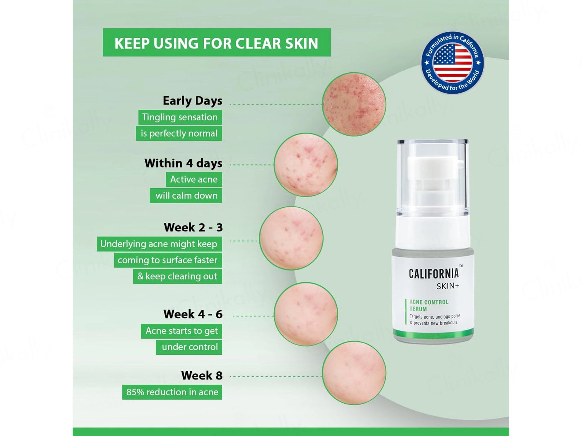 California Skin Acne Control Serum