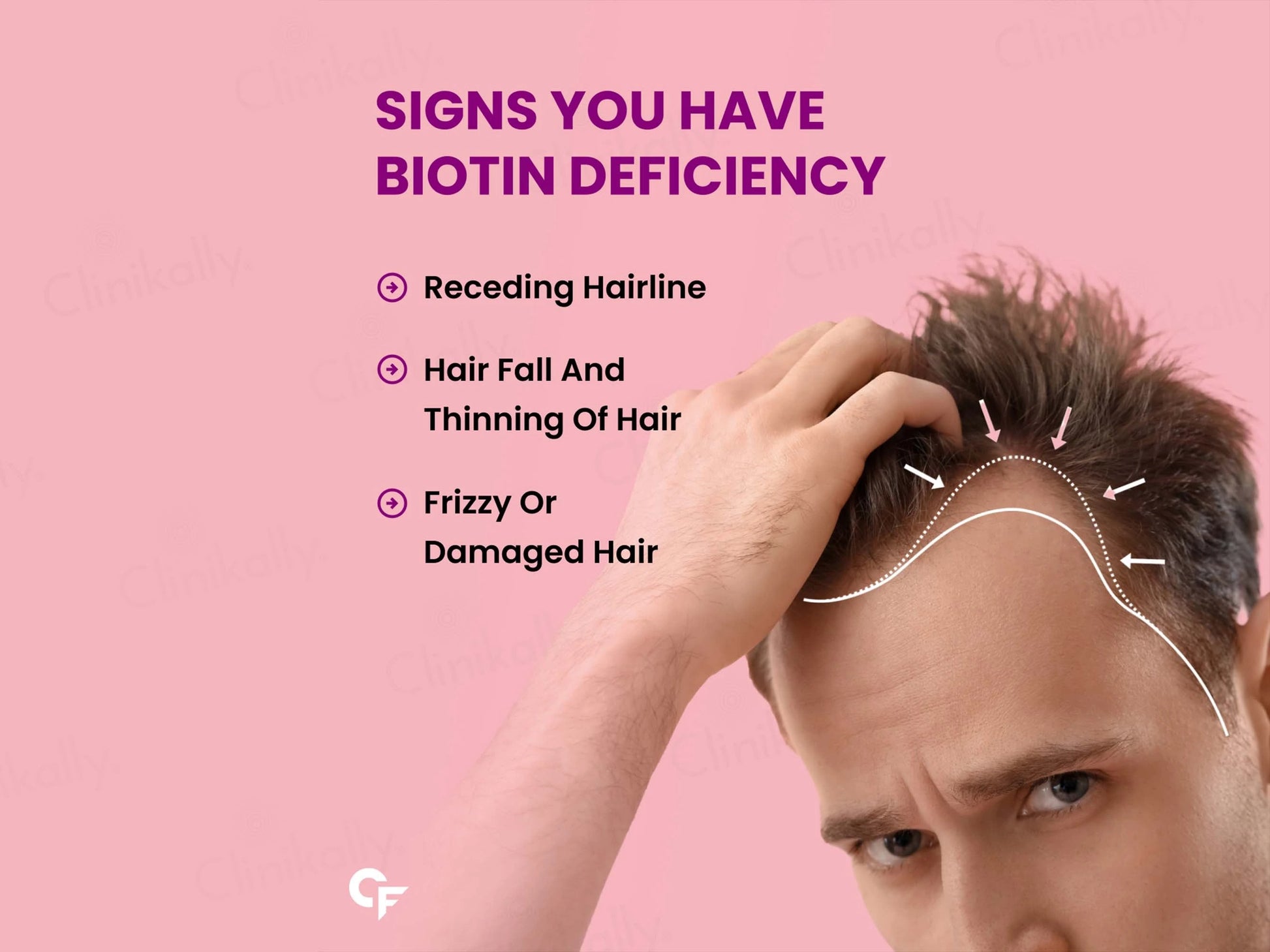 Carbamide Forte Biotin 10000mcg Tablet