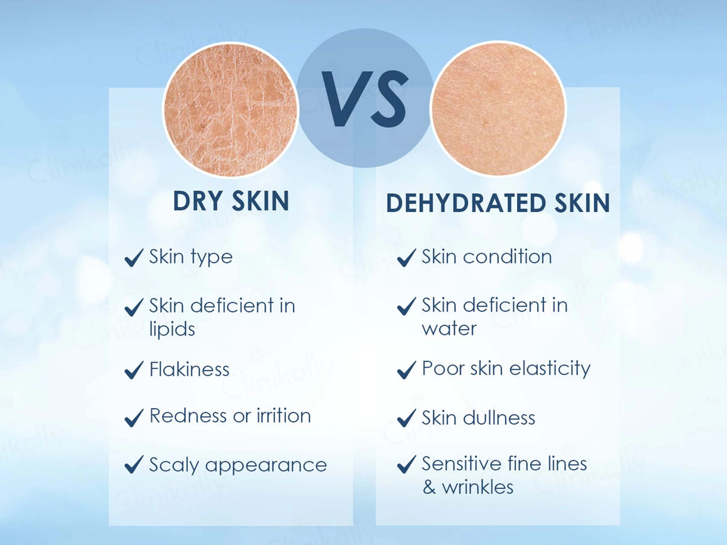 Cetaphil Optimal Hydration Daily Cream
