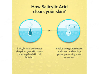 Chemist At Play 2 Percent Salicylic Acid Acne Control Face Serum