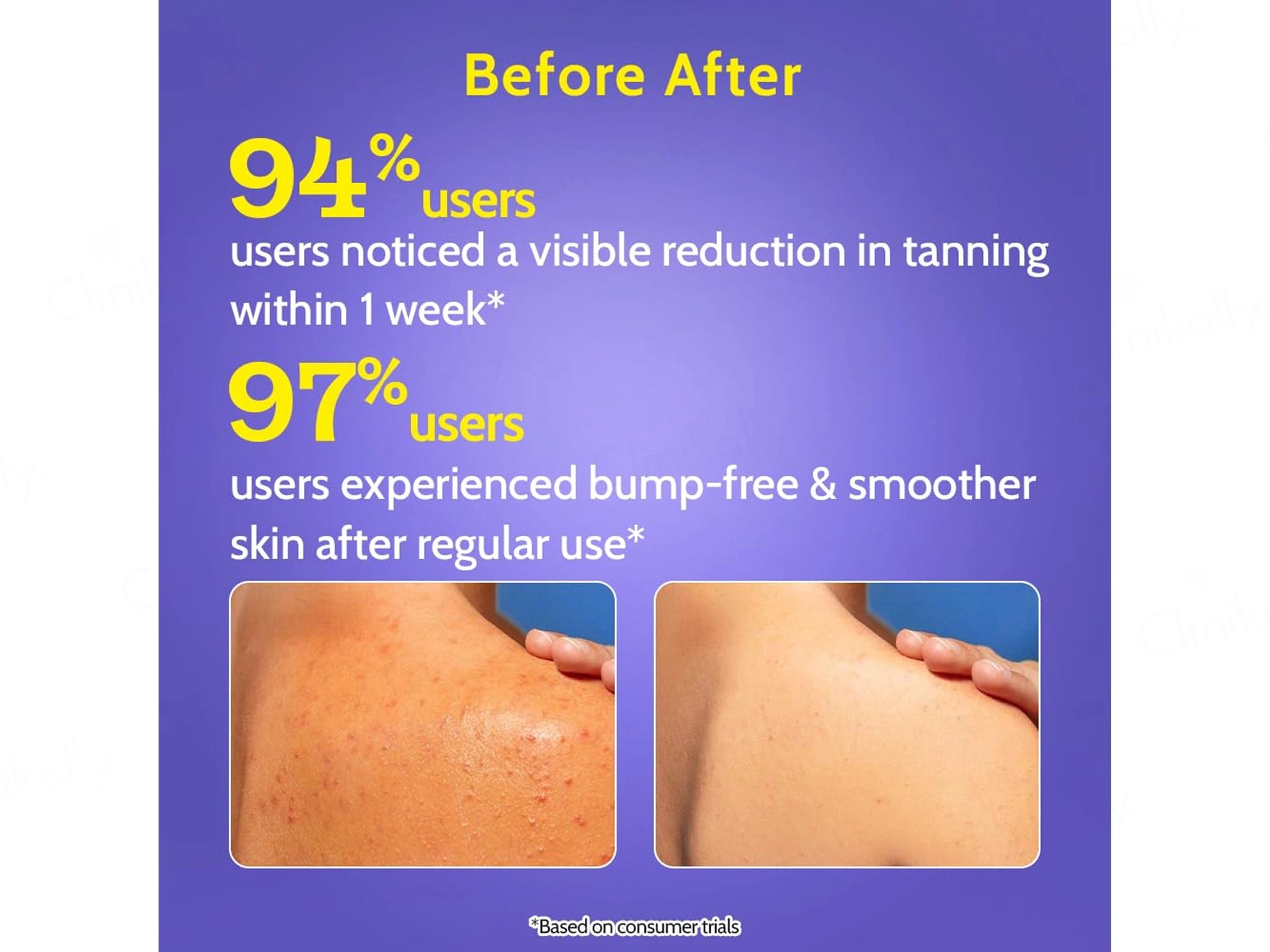Chemist At Play 4 Percent Daily Exfoliating Body Wash