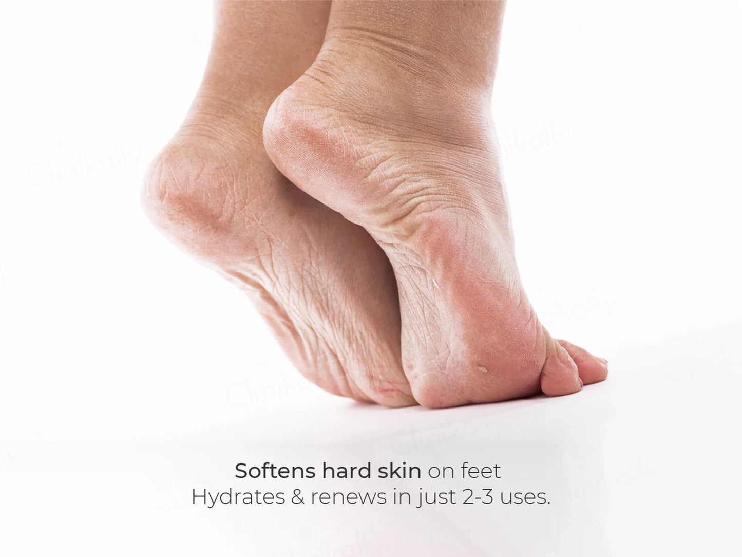 CodeSkin Velvet Foot Skin Softening Cream For Dry and  Cracked Feet