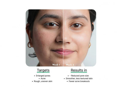 CosIQ Vitamin B3-5 Percent Niacinamide Face Serum