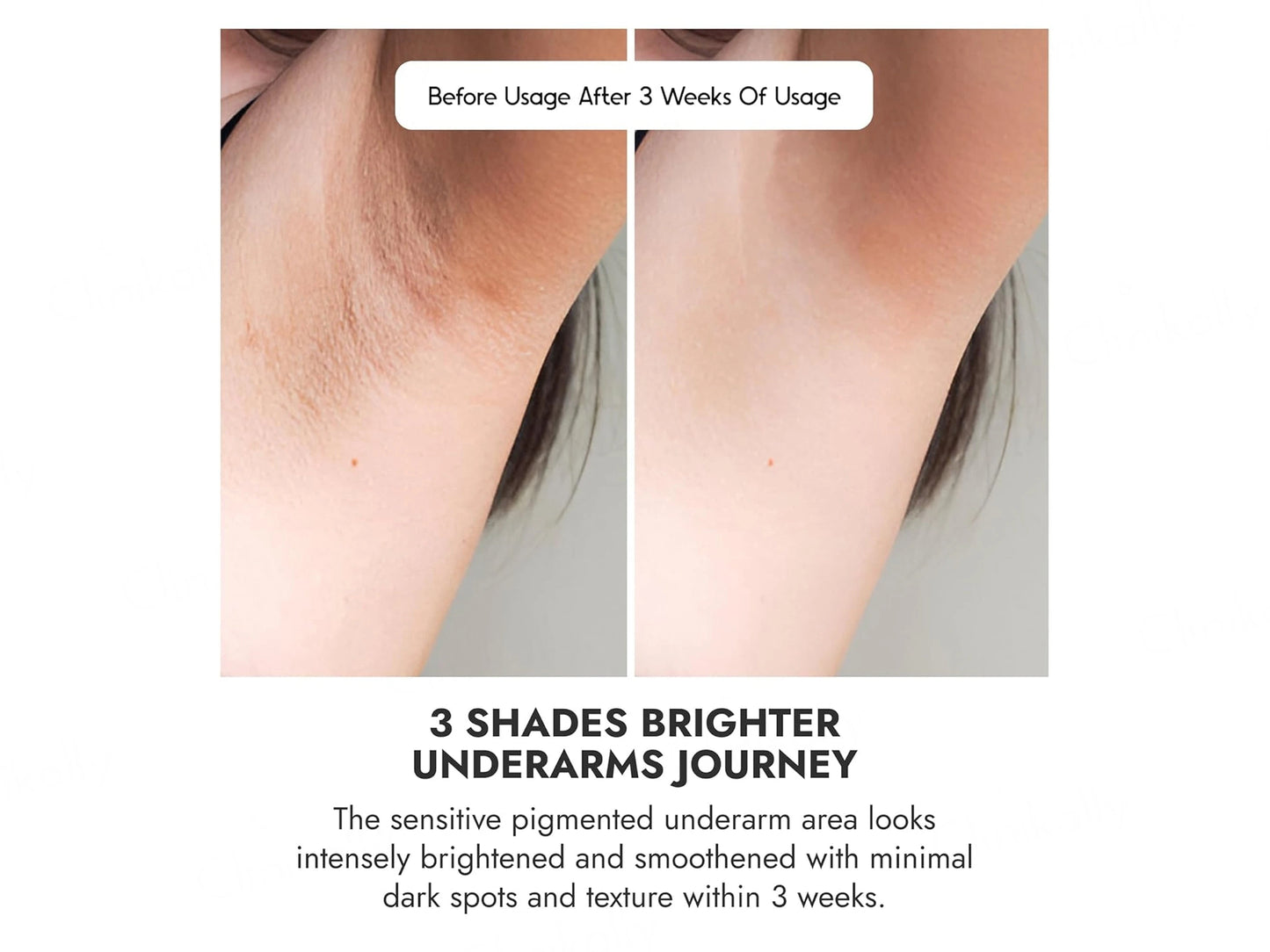 CosiQ Underarm Roll-On Serum With Mandelic Acid