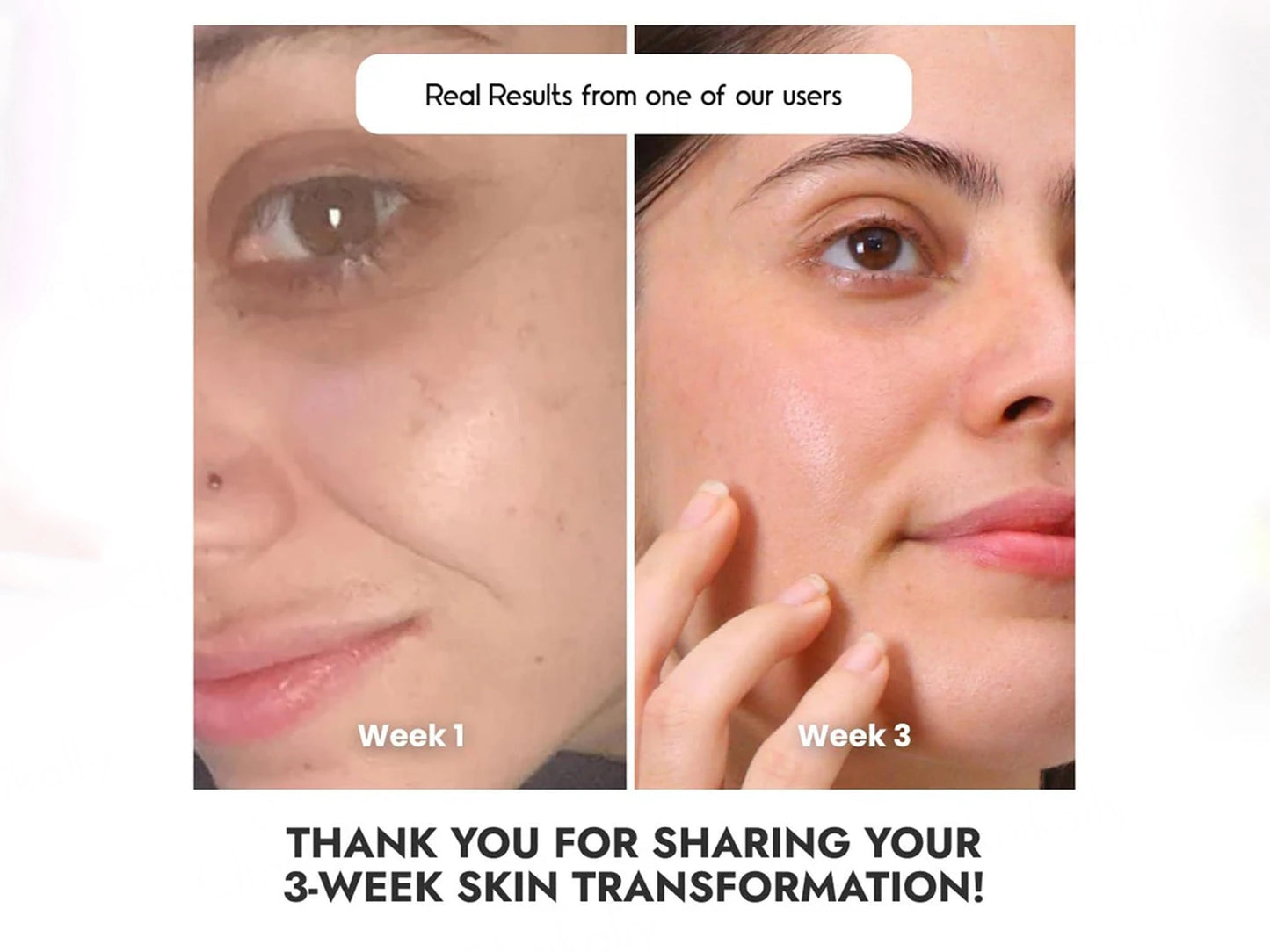 CosiQ Vitamin C-8 Percent Ethylated Ascorbic Acid Face Serum