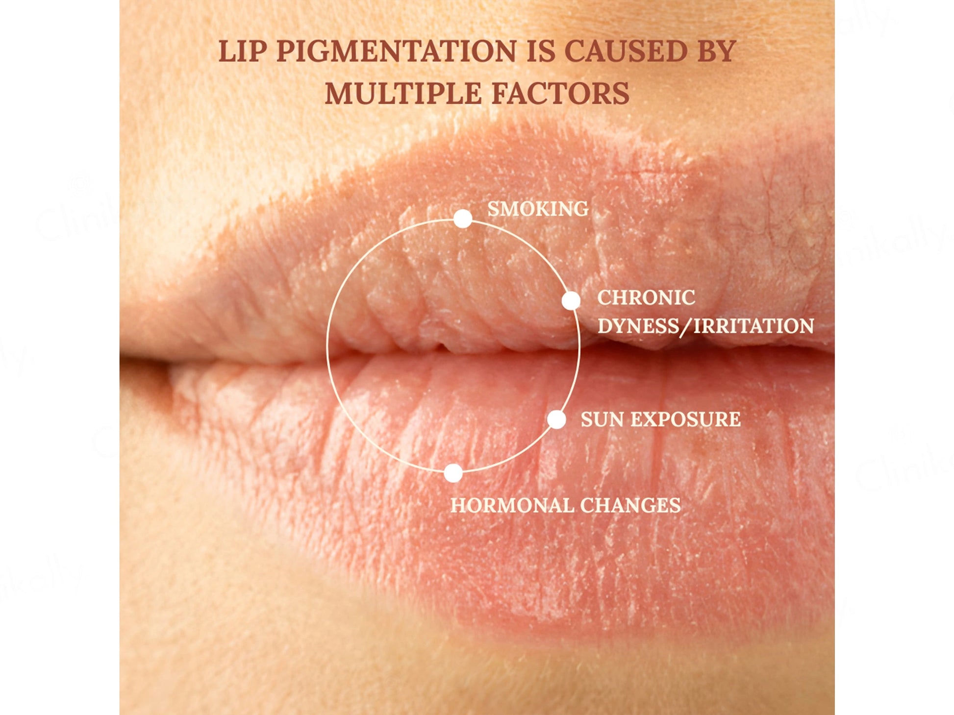 DERMAIN Lip Lightening Balm SPF 30