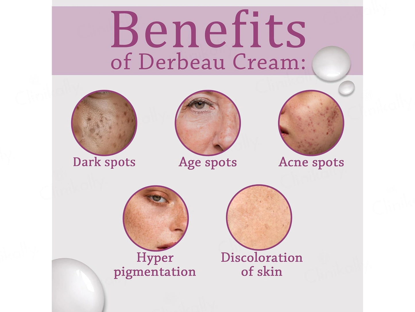 Derbeau-12 Percent Cream