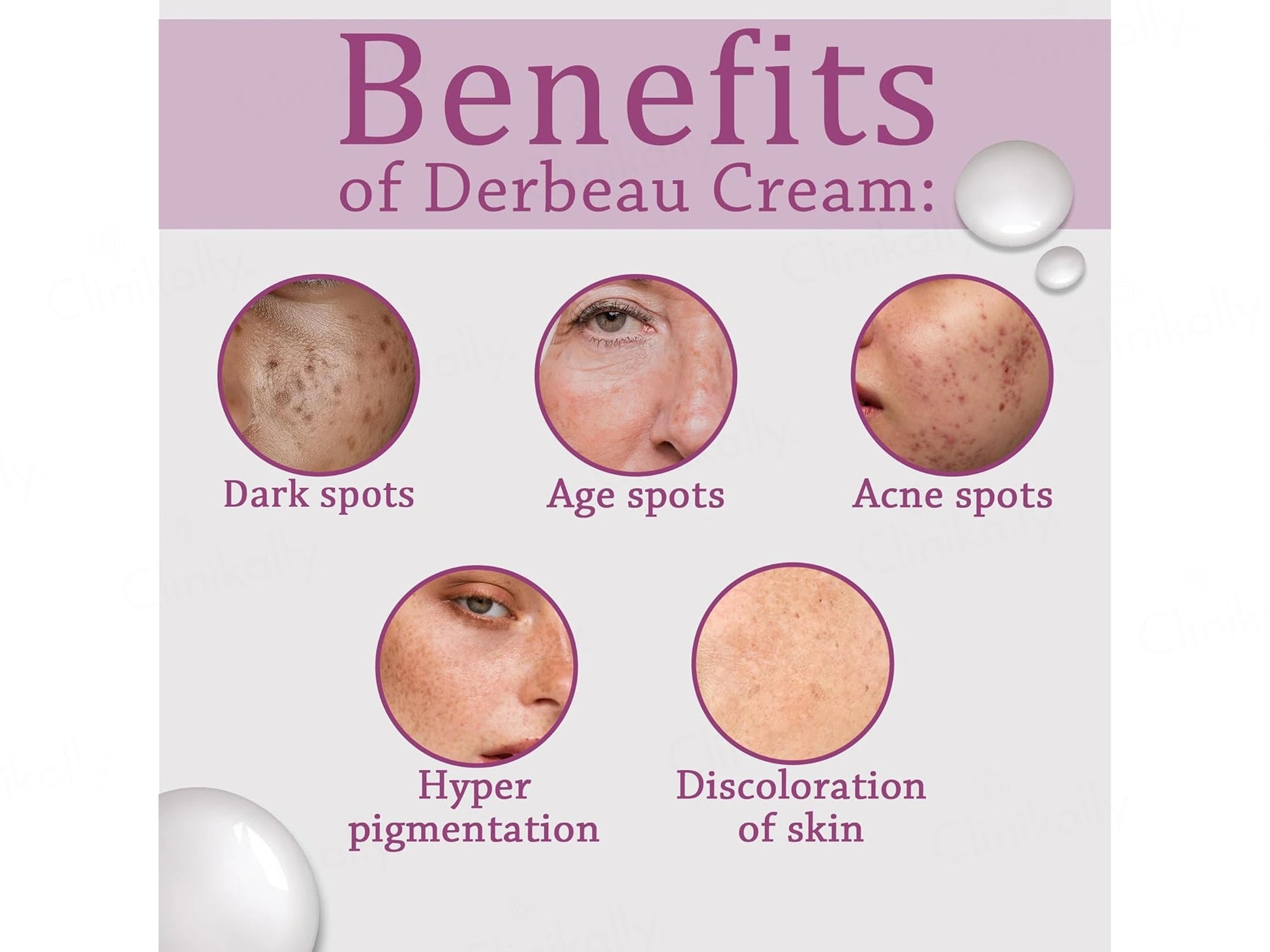 Derbeau-12 Percent Cream