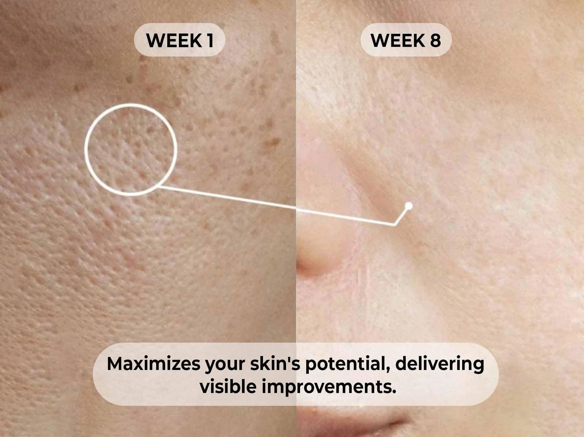 Dermabay 5 Percent Niacinamide  1 Percent Hyaluronic Acid Face Serum