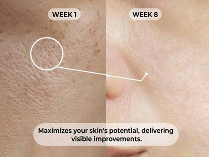 Dermabay 5 Percent Niacinamide  1 Percent Hyaluronic Acid Face Serum