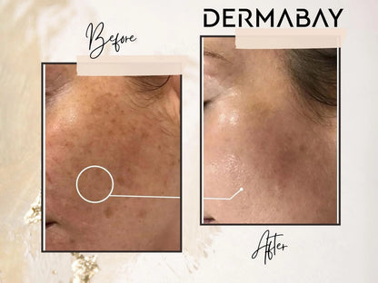 Dermabay Brightening Face Serum