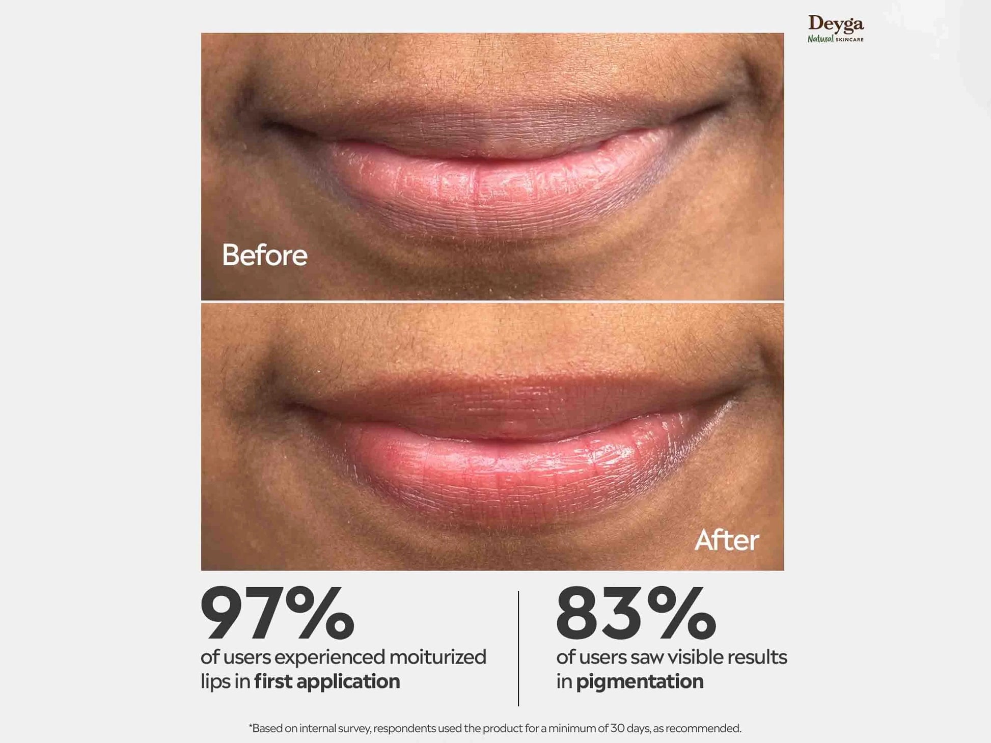 Deyga Beetroot Lip Balm 8Hrs Hydration