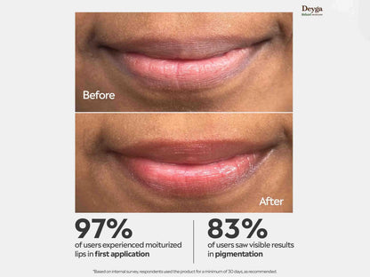 Deyga Beetroot Lip Balm 8Hrs Hydration