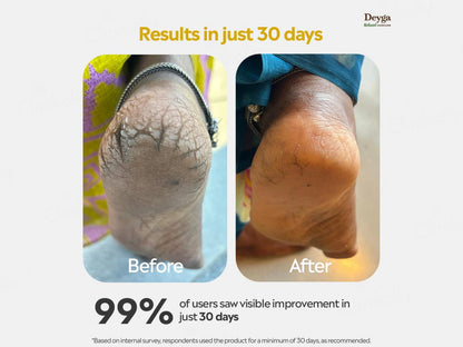 Deyga Foot Butter