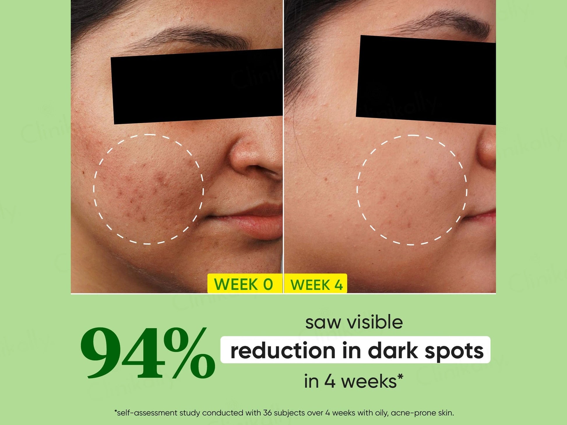 Dot and  Key Cica  10 Percent Niacinamide Spot Reduction Face Serum