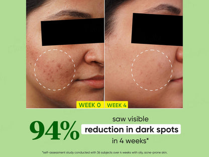 Dot and  Key Cica  10 Percent Niacinamide Spot Reduction Face Serum