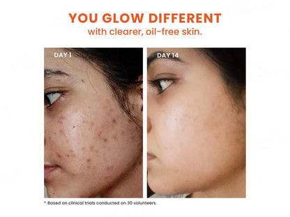 Foxtale 12 Percent Niacinamide  Azelaic Acid Clarifying Serum