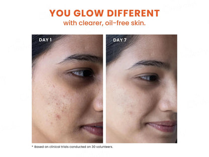 Foxtale Oil and  Acne Control Face Wash