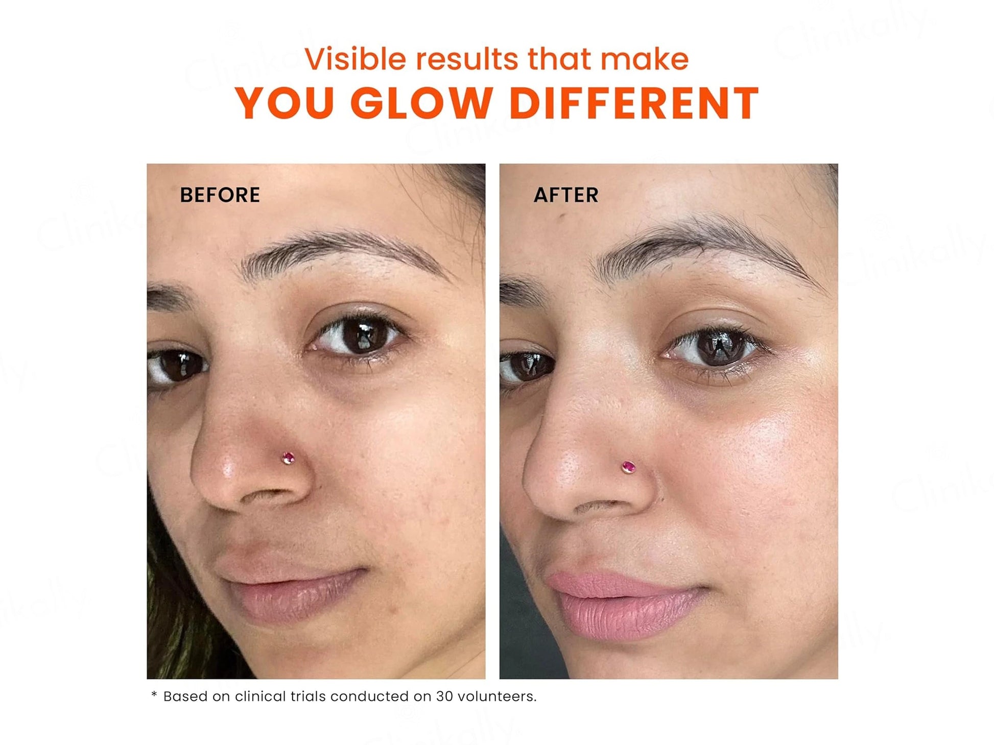 Foxtale Skin Radiance Face Mask