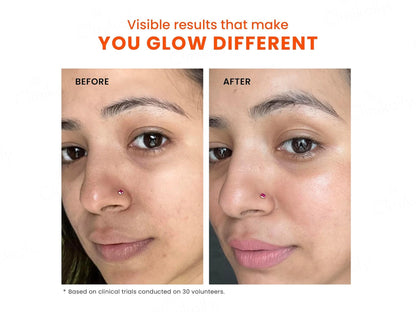 Foxtale Skin Radiance Face Mask
