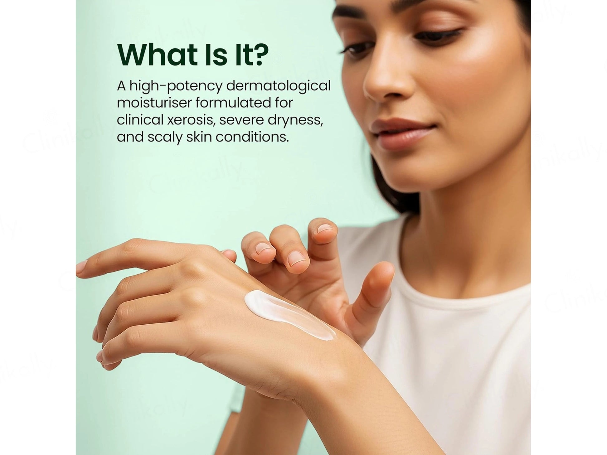 NMFe Urea 20 Percent Cream For Very Dry and  Sensitive Skin