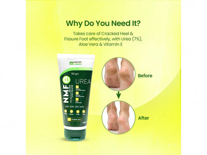 NMFe Urea and Aloe Vera Cream For Very Dry Skin