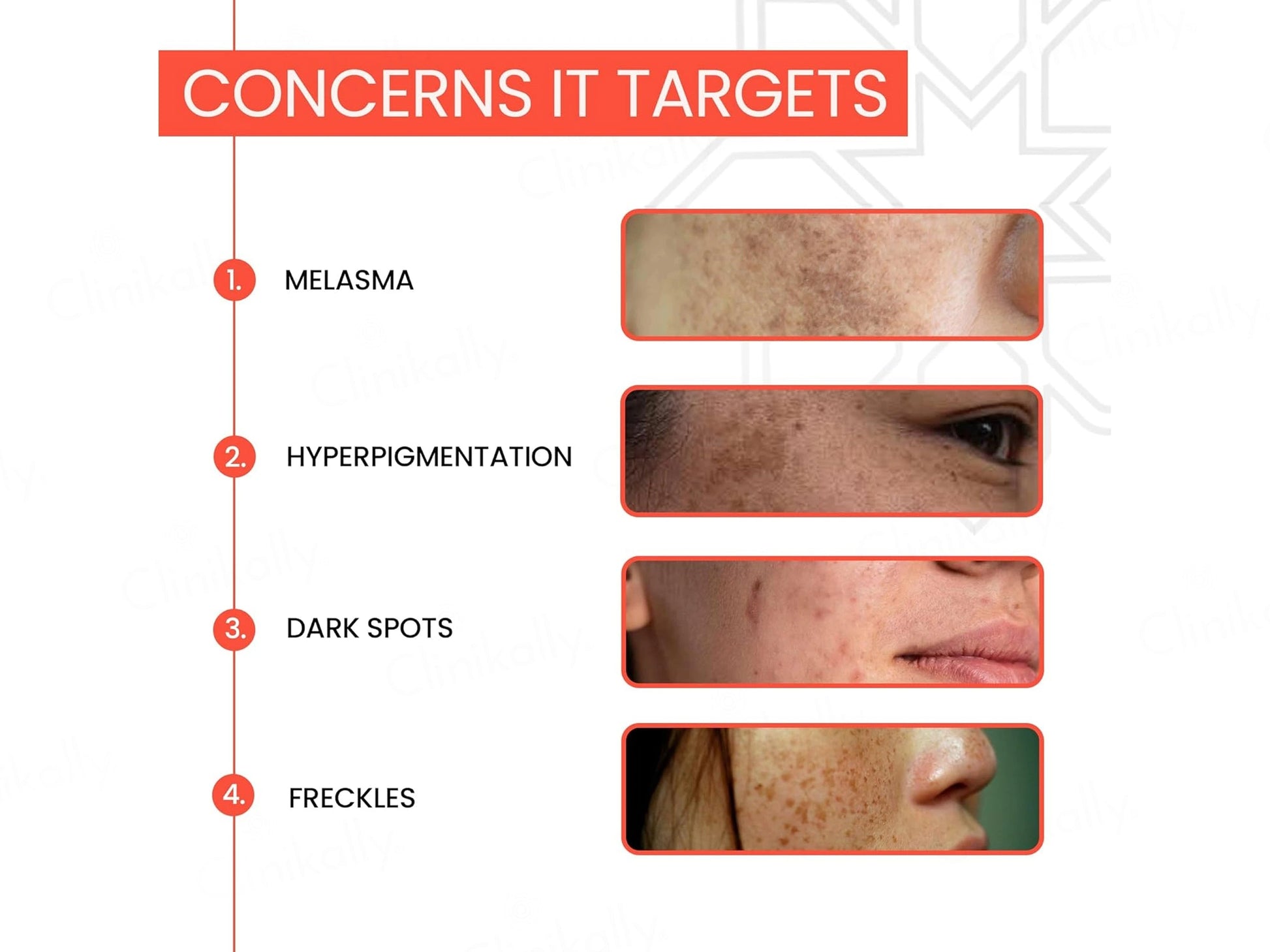 Novilite Depigmenting and  Skin Brightening Cream