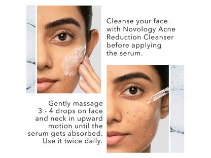 Novology PHA Oily Skin Serum