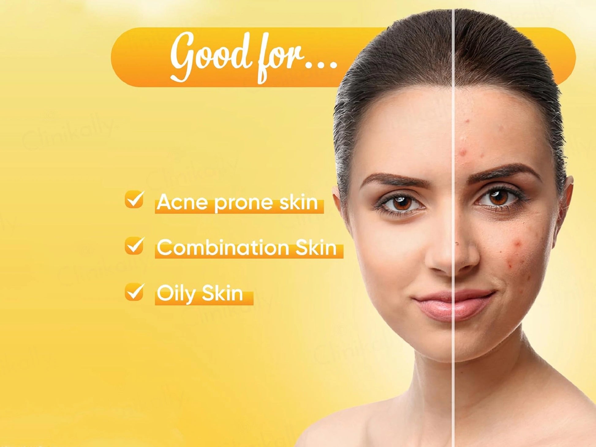 Ozone Acne Check Face Wash