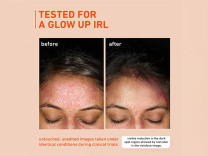 Plum 15 Percent Vitamin C Glow Boost Face Serum With Mandarin