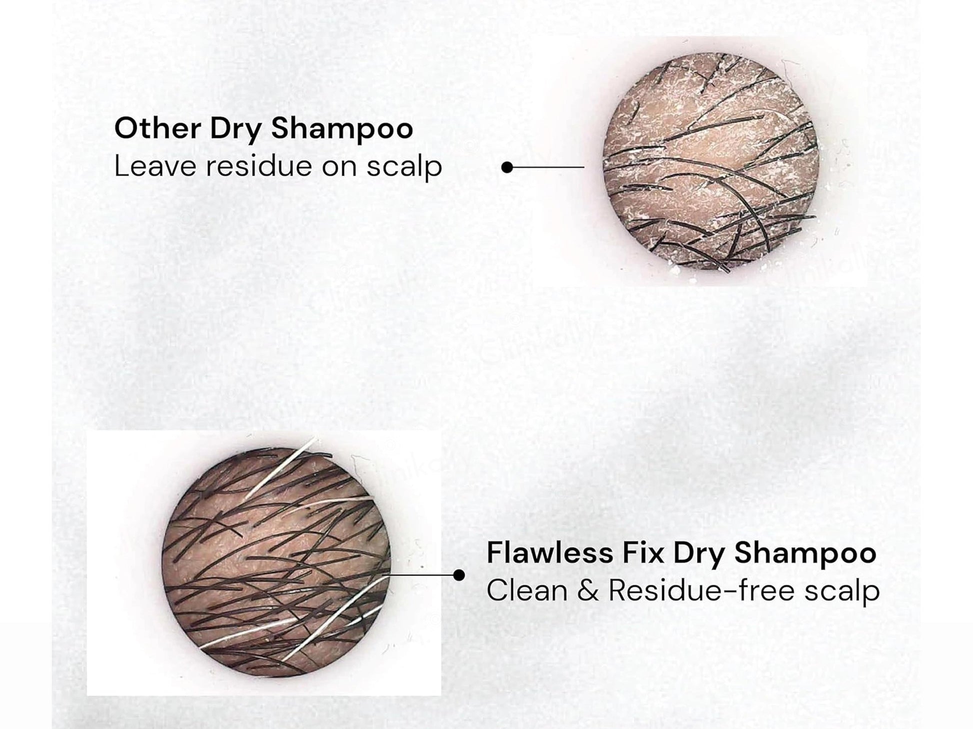 Renewcell Flawless Fix Dry Shampoo