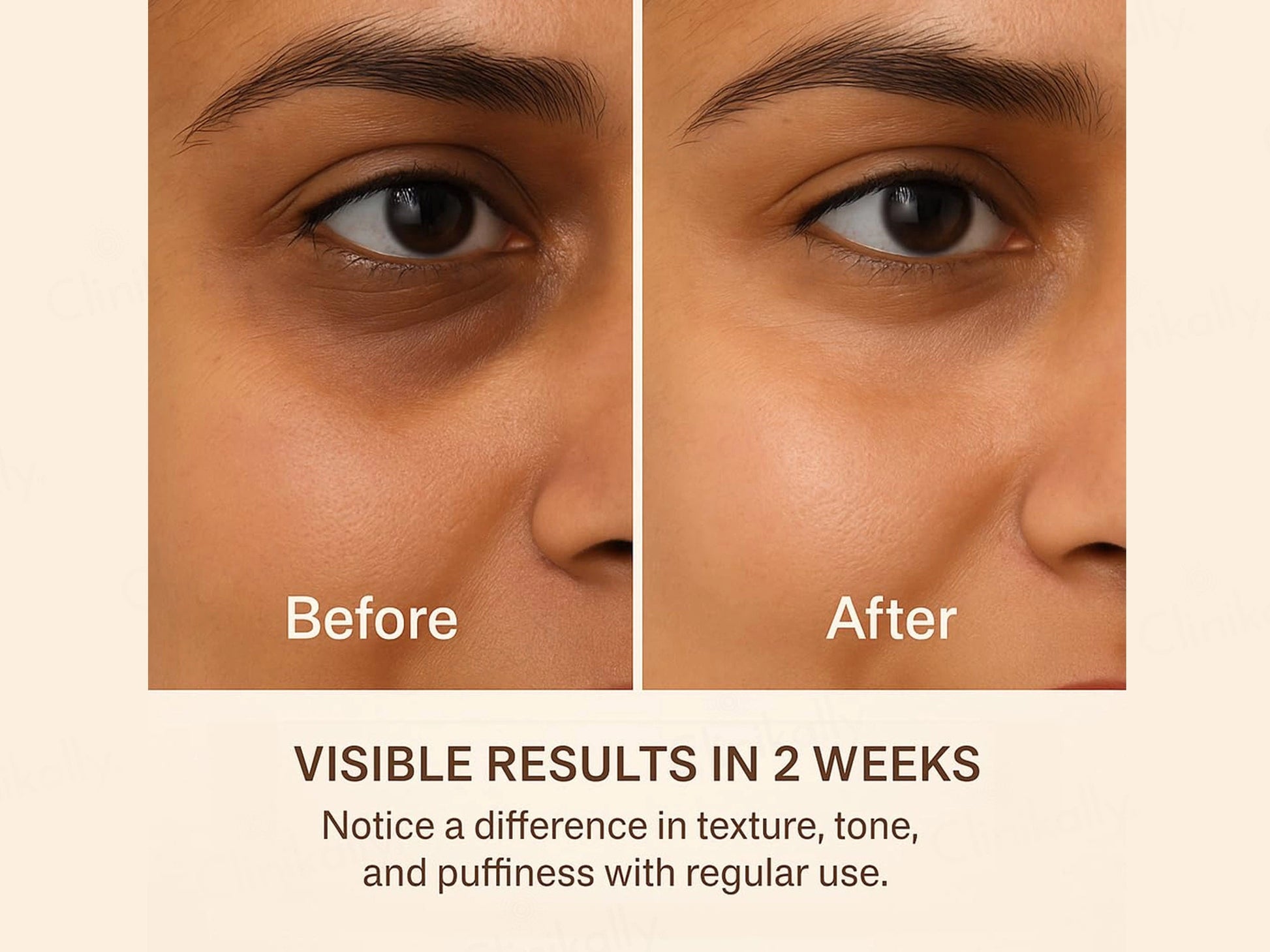 SKOG FER Under Eye Repair Oil