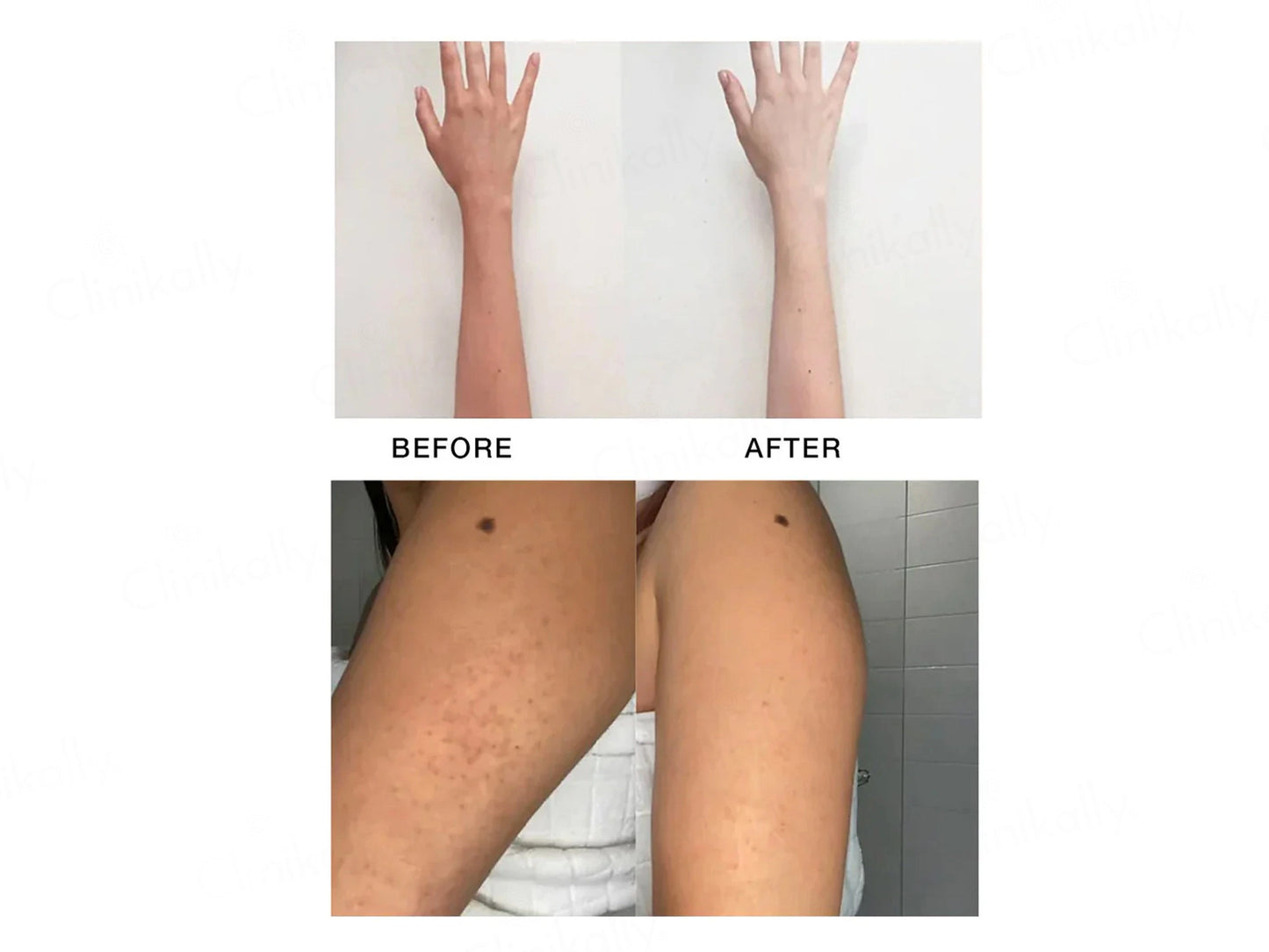 SKOG ODC De-Tan Cream