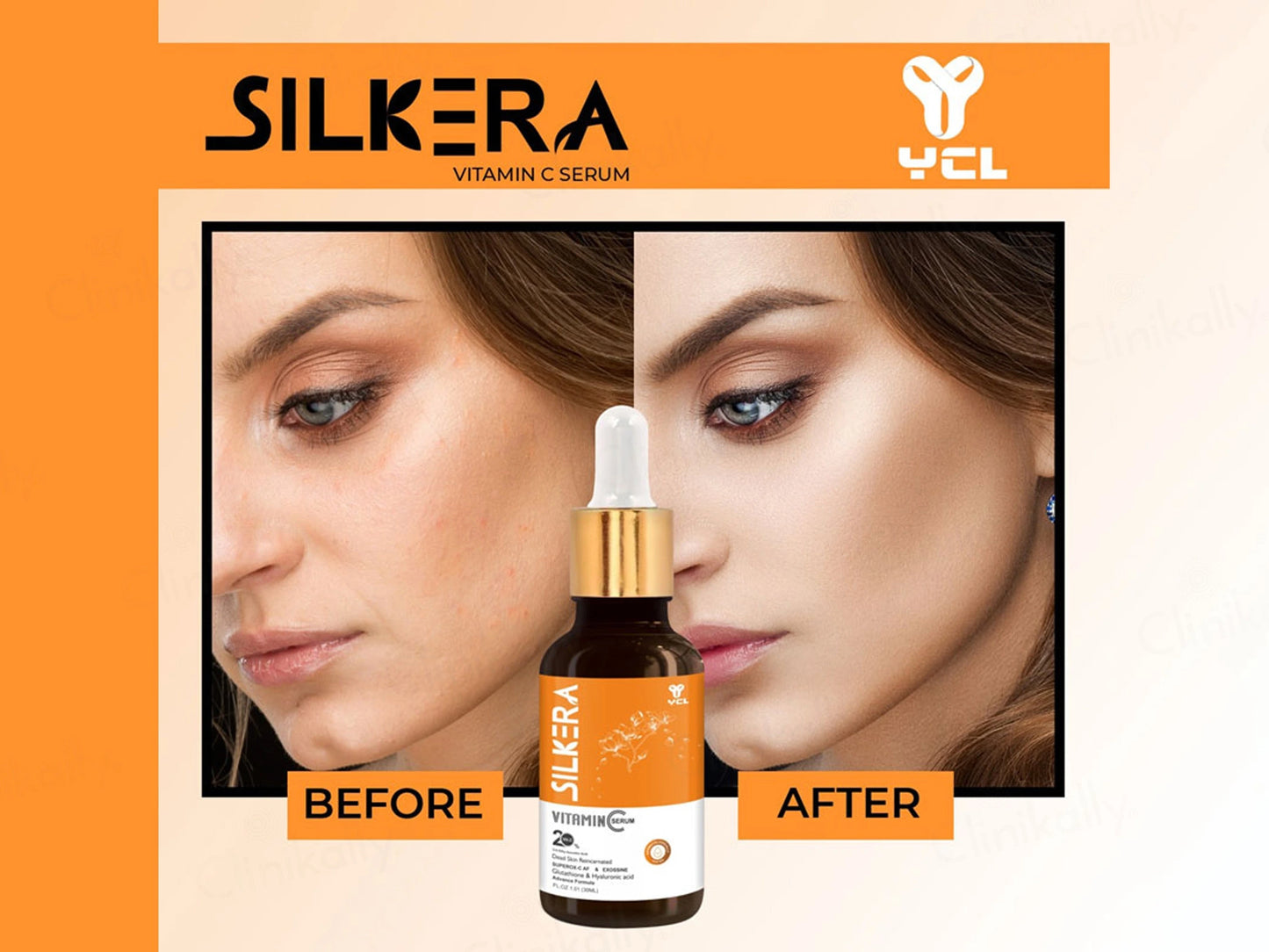 Silkera 20 Percent Vitamin C Serum