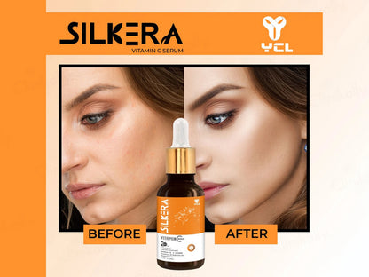Silkera 20 Percent Vitamin C Serum