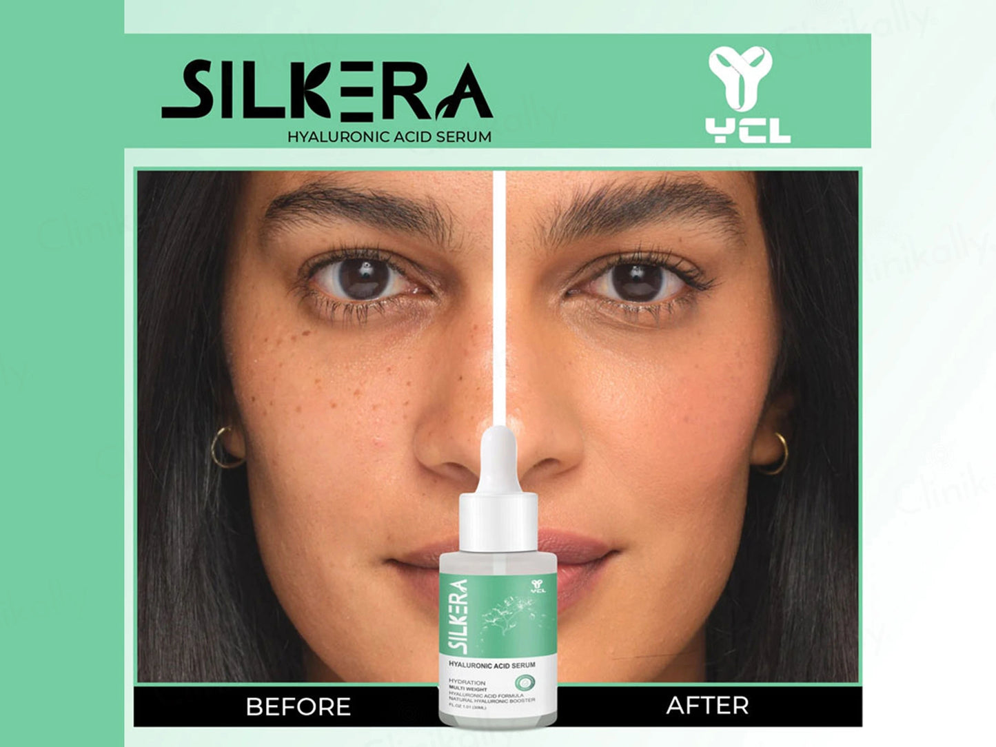 Silkera Hyaluronic Acid Serum