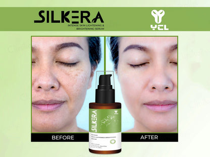 Silkera Skin Lightening and  Brightening Serum